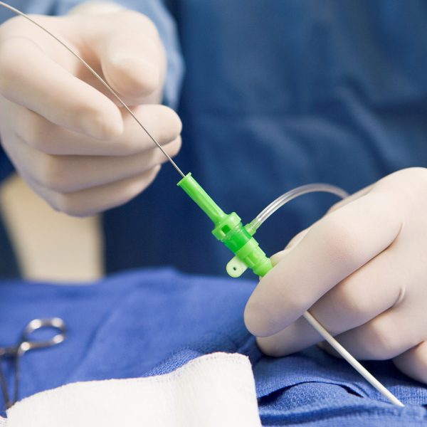 AnjiyoBalonStent uygulama 600x600